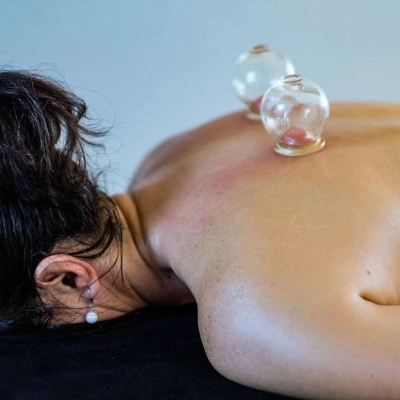 Cupping - Acupuncture in Reading, Berkshire and Surrounding Areas - Lina Doyle