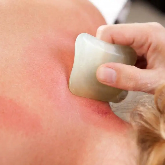 Gua Sha - Acupuncture in Reading, Berkshire and Surrounding Areas - Lina Doyle