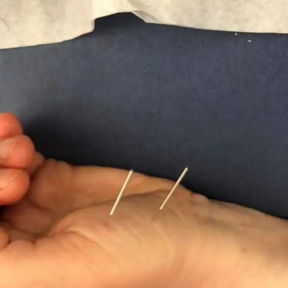 Master Tung's Acupuncture - Acupuncture in Reading, Berkshire and Surrounding Areas - Lina Doyle